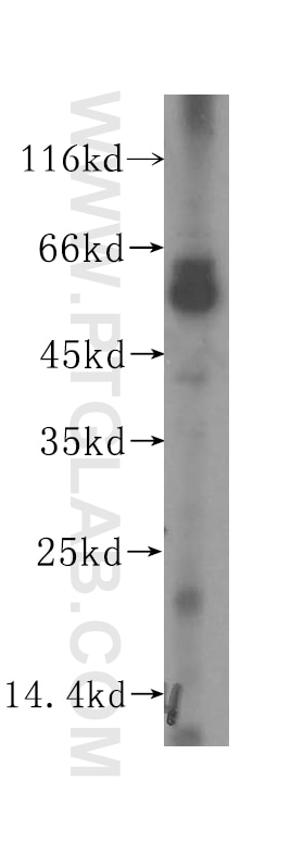 Western Blot (WB) analysis of mouse liver tissue using SDSL Polyclonal antibody (16242-1-AP)
