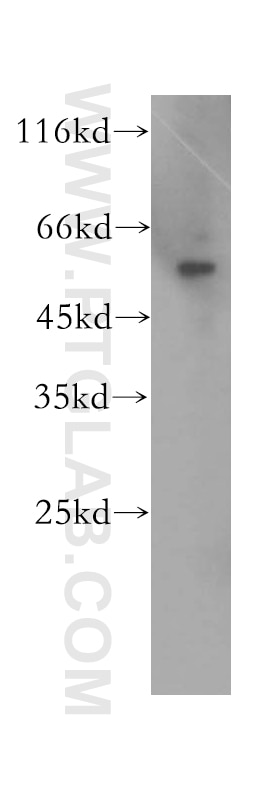 Western Blot (WB) analysis of mouse lung tissue using SDSL Polyclonal antibody (16242-1-AP)