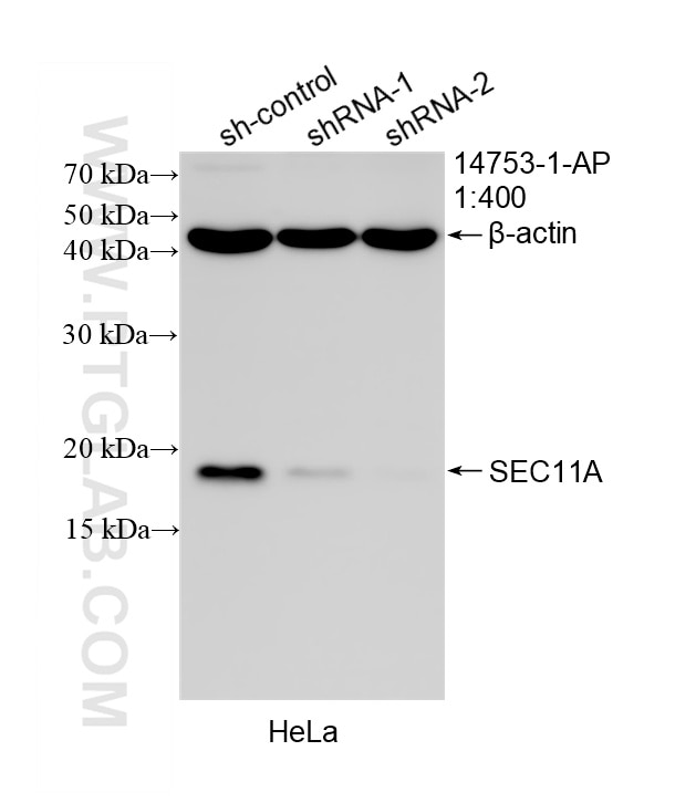 WB result of SEC11A antibody (14753-1-AP; 1:400; incubated at room temperature for 1.5 hours) with sh-Control and sh-SEC11A transfected HeLa cells. Western Blot (WB) analysis of HeLa cells using SEC11A Polyclonal antibody (14753-1-AP)
