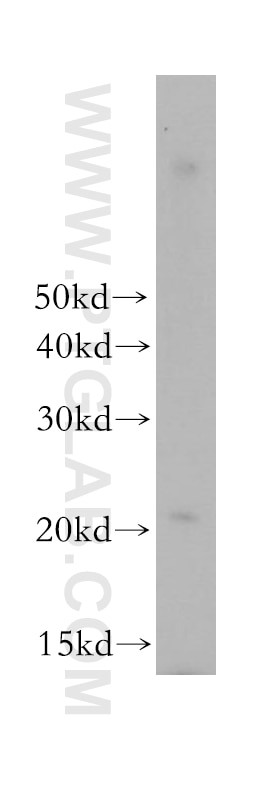 Western Blot (WB) analysis of human colon tissue using SEC11A Polyclonal antibody (14753-1-AP)