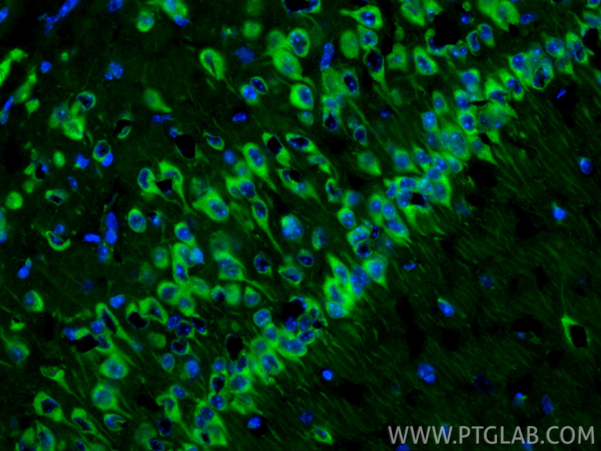 Immunofluorescence (IF) / fluorescent staining of mouse brain tissue using SEC13 Polyclonal antibody (15397-1-AP)