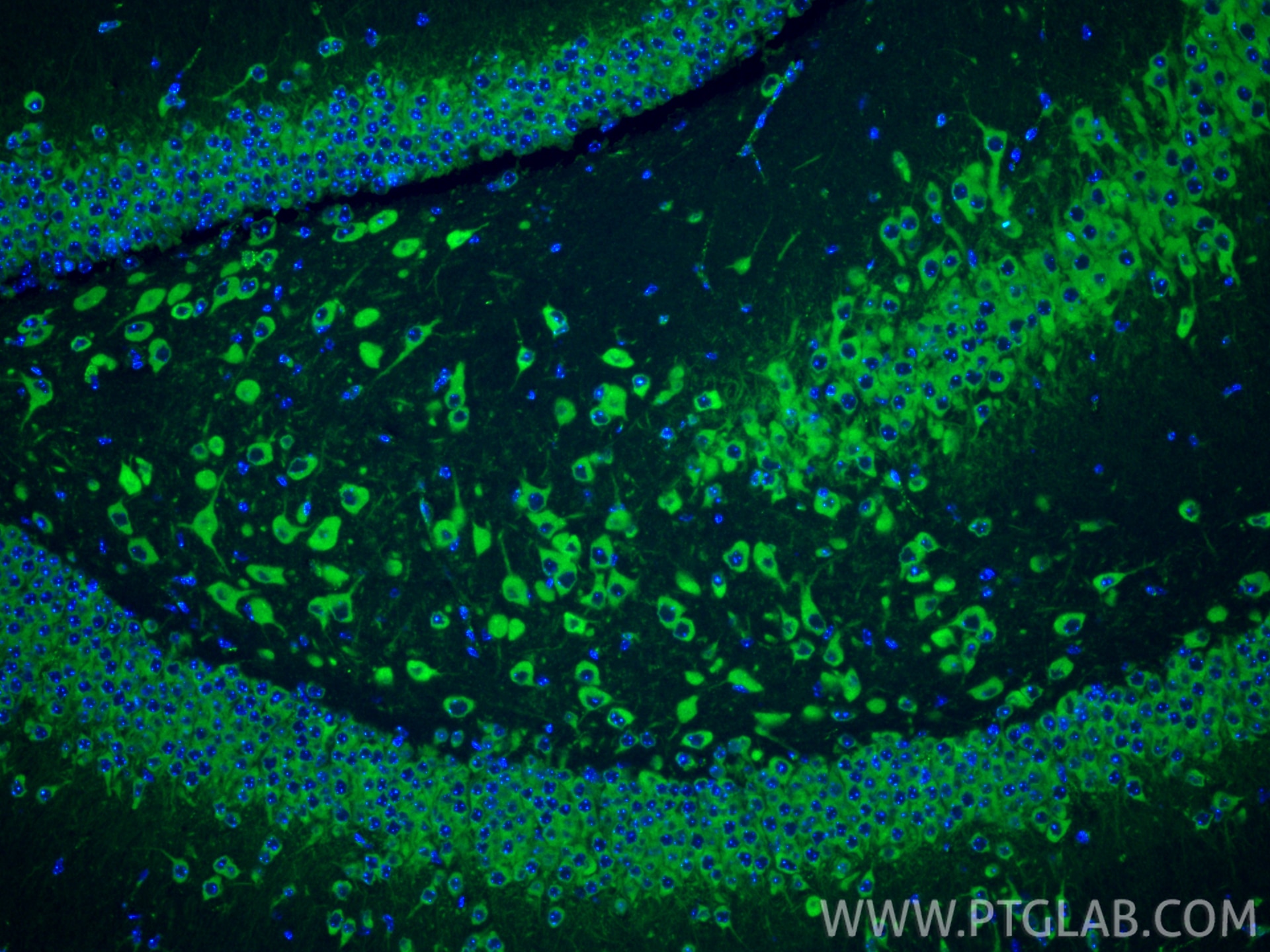 Immunofluorescence (IF) / fluorescent staining of mouse brain tissue using SEC13 Polyclonal antibody (15397-1-AP)