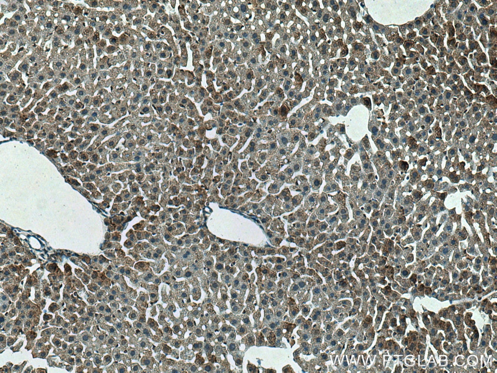 IHC staining of mouse liver using 15397-1-AP