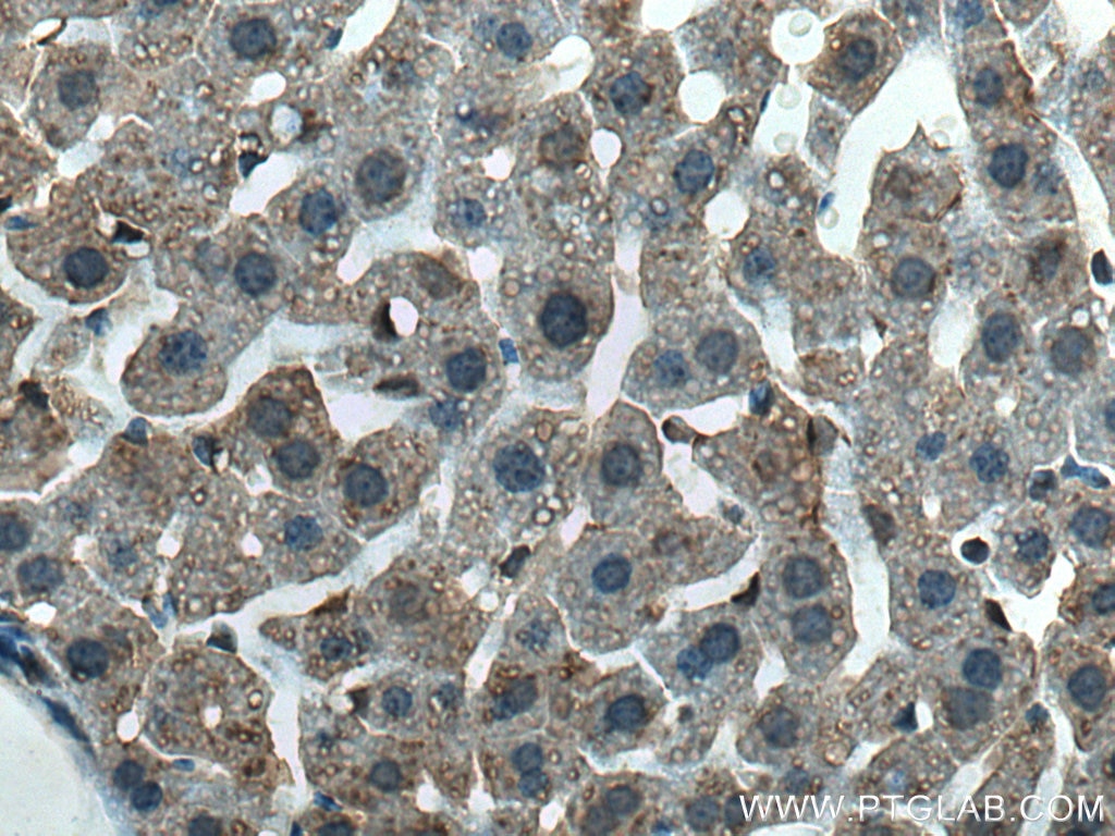 IHC staining of mouse liver using 15397-1-AP