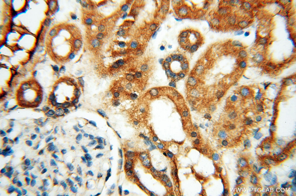 IHC staining of human kidney using 15397-1-AP