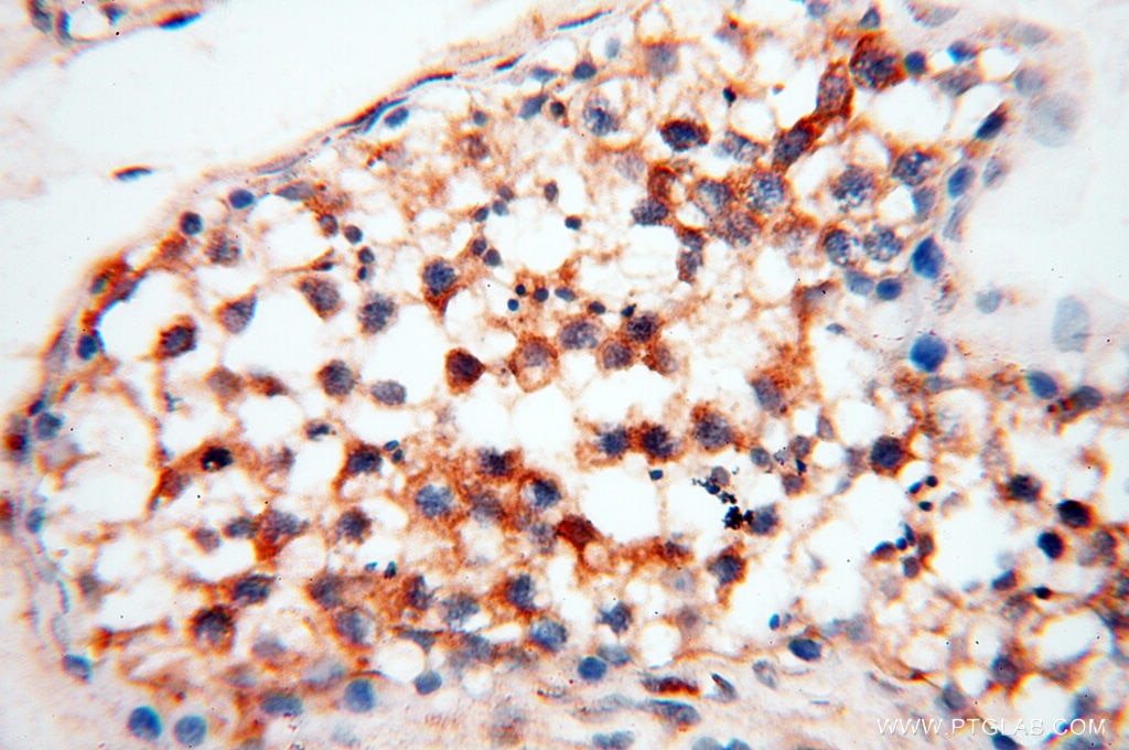 Immunohistochemistry (IHC) staining of human testis tissue using SEC13 Polyclonal antibody (15397-1-AP)