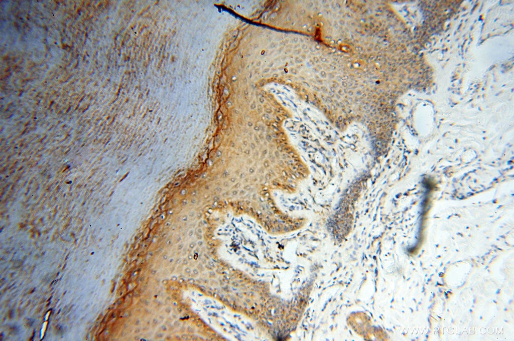 Immunohistochemistry (IHC) staining of human skin tissue using SEC13 Polyclonal antibody (15397-1-AP)