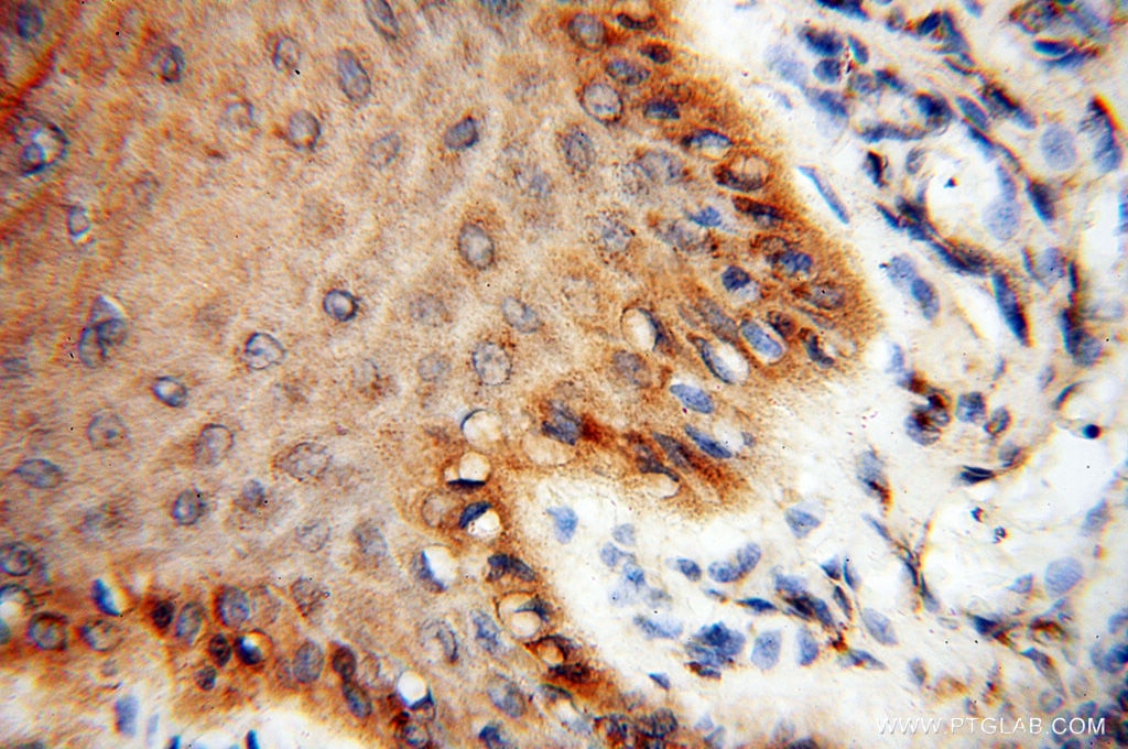 Immunohistochemistry (IHC) staining of human skin tissue using SEC13 Polyclonal antibody (15397-1-AP)