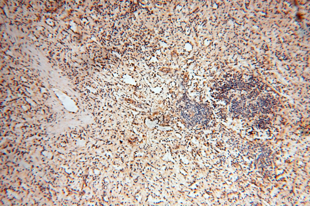 Immunohistochemistry (IHC) staining of human spleen tissue using SEC13 Polyclonal antibody (15397-1-AP)