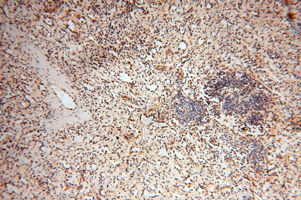 IHC staining of human spleen using 15397-1-AP