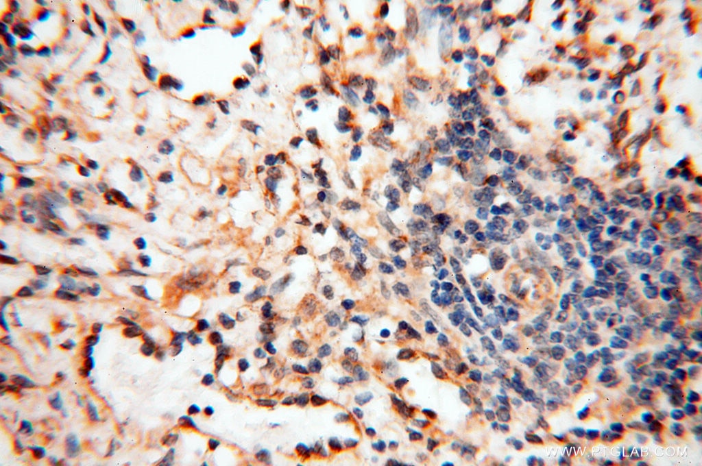 Immunohistochemistry (IHC) staining of human spleen tissue using SEC13 Polyclonal antibody (15397-1-AP)