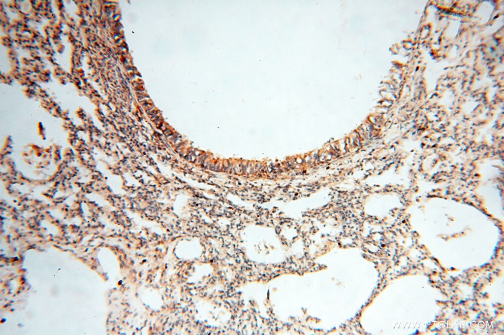Immunohistochemistry (IHC) staining of human lung tissue using SEC13 Polyclonal antibody (15397-1-AP)