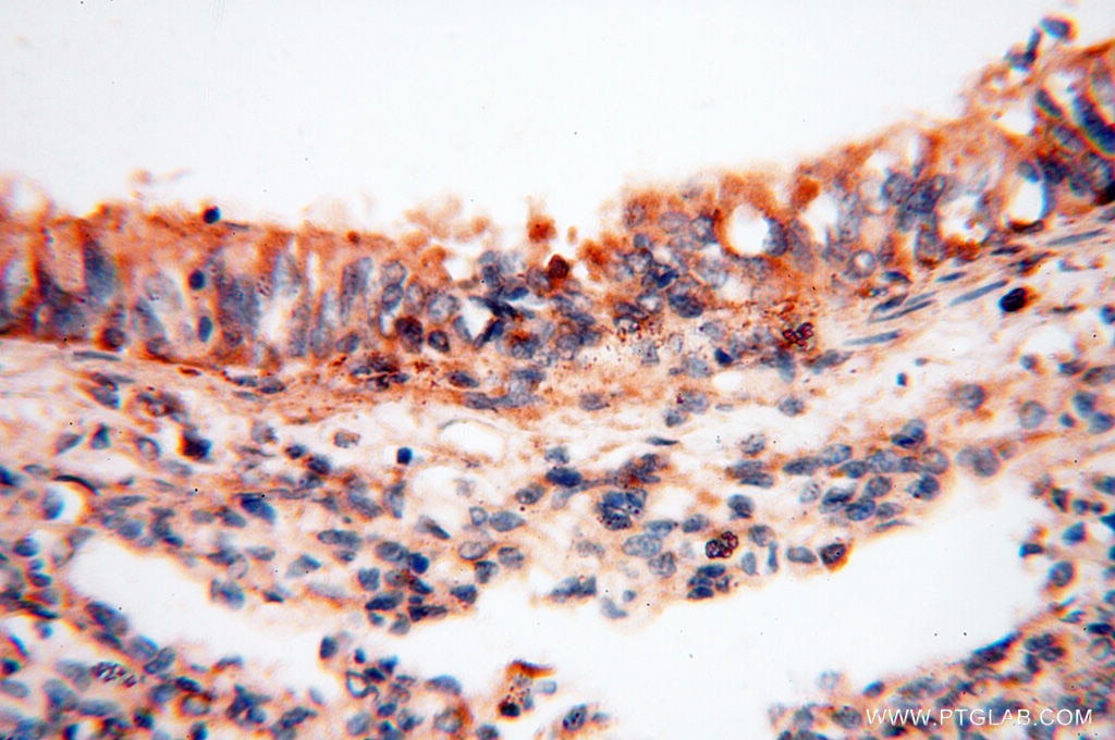 Immunohistochemistry (IHC) staining of human lung tissue using SEC13 Polyclonal antibody (15397-1-AP)