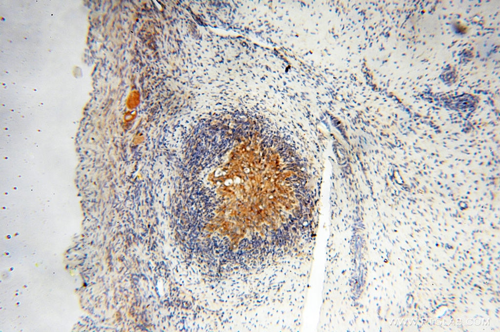 Immunohistochemistry (IHC) staining of human ovary tissue using SEC13 Polyclonal antibody (15397-1-AP)