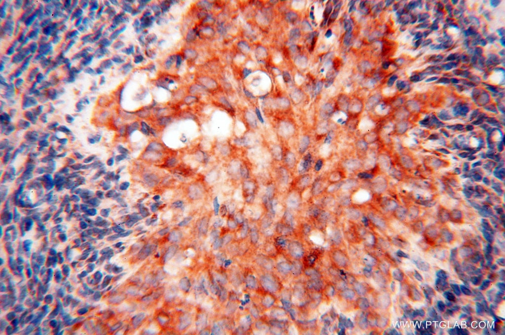 Immunohistochemistry (IHC) staining of human ovary tissue using SEC13 Polyclonal antibody (15397-1-AP)