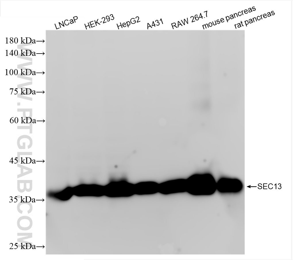 Western Blot (WB) analysis of various lysates using SEC13 Recombinant antibody (85110-4-RR)