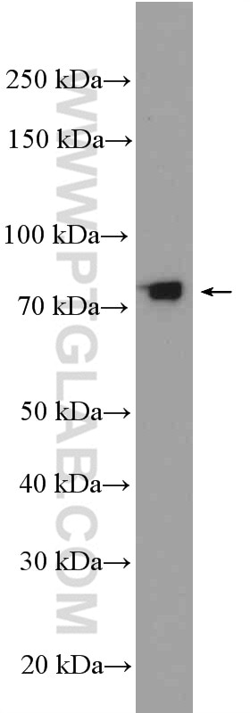 Western Blot (WB) analysis of Y79 cells using SEC14L1 Polyclonal antibody (25541-1-AP)
