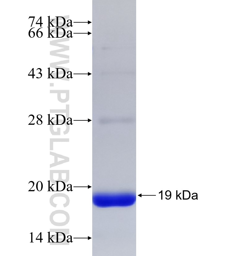 SEC14L1 fusion protein Ag33108 SDS-PAGE SEC14L1 fusion protein Ag33108 SDS-PAGE
