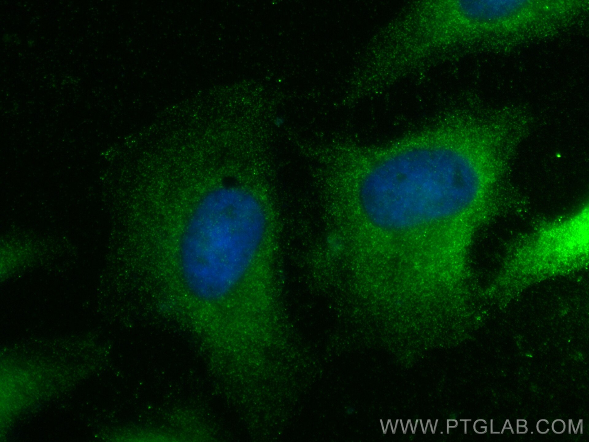 Immunofluorescence (IF) / fluorescent staining of HeLa cells using SEC14L3 Polyclonal antibody (32098-1-AP)
