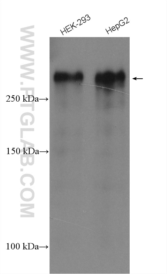 Western Blot (WB) analysis of various lysates using SEC16A Polyclonal antibody (29417-1-AP)