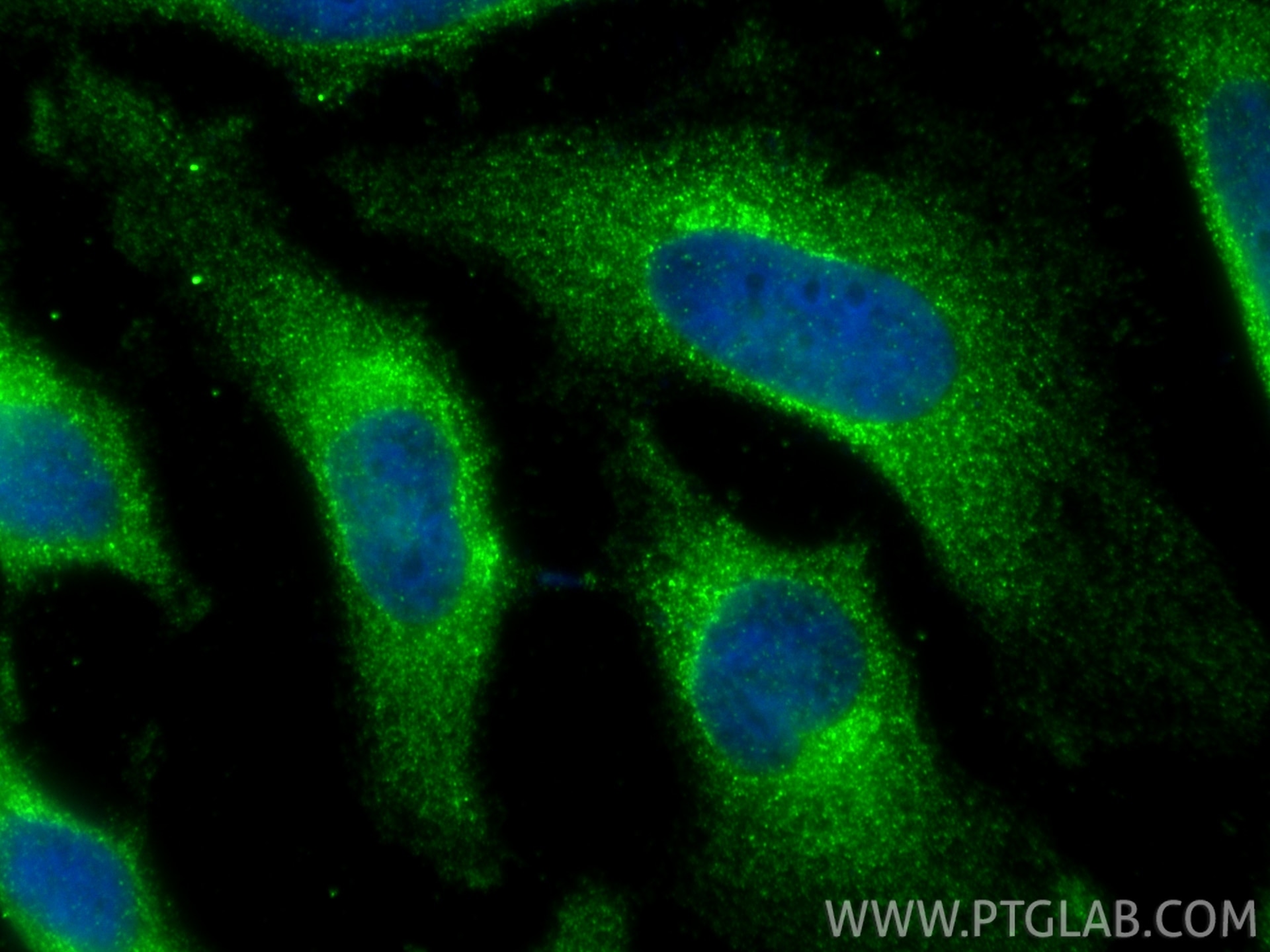 Immunofluorescent analysis of (-20°C Ethanol) fixed HeLa cells using SEC16A antibody (68493-1-Ig, Clone: 1D9A5 ) at dilution of 1:800 and CoraLite®488-Conjugated Goat Anti-Mouse IgG(H+L) (SA00013-1). Immunofluorescence (IF) / fluorescent staining of HeLa cells using SEC16A Monoclonal antibody (68493-1-Ig)