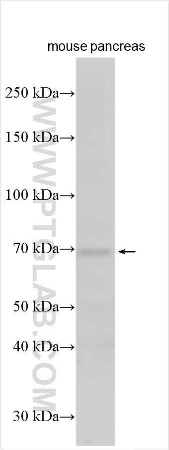 Western Blot (WB) analysis of various lysates using SEC16B Polyclonal antibody (17245-1-AP)
