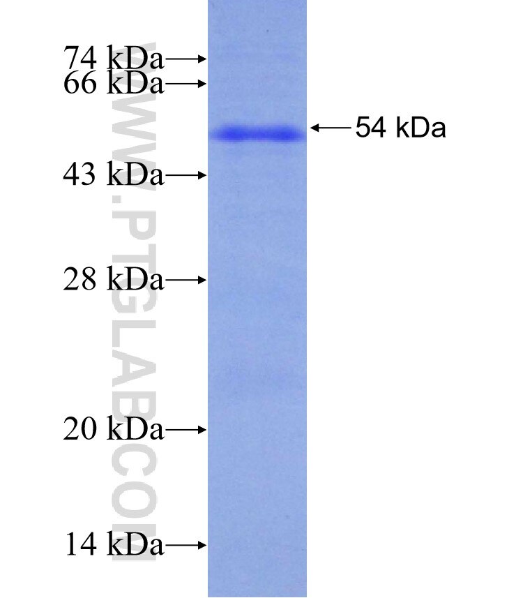 SEC16B fusion protein Ag30069 SDS-PAGE