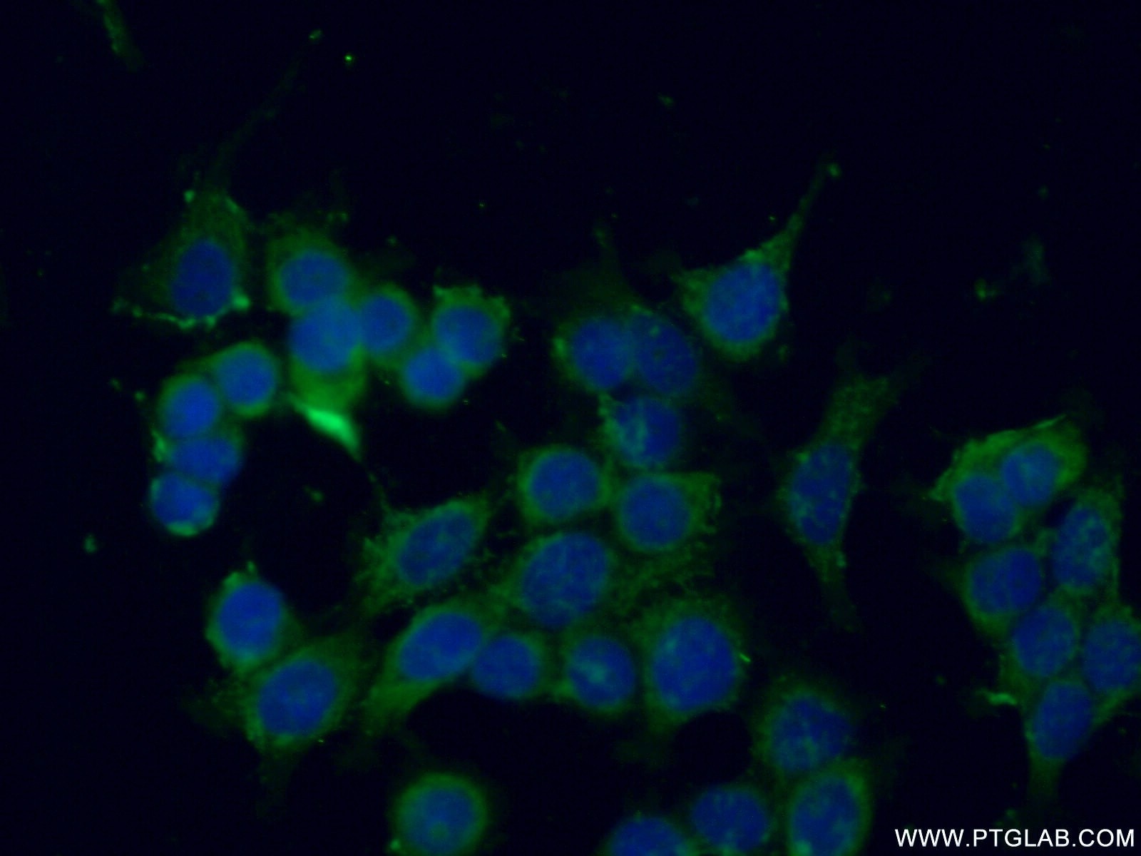 Immunofluorescence (IF) / fluorescent staining of MCF-7 cells using SEC22B Polyclonal antibody (14776-1-AP)