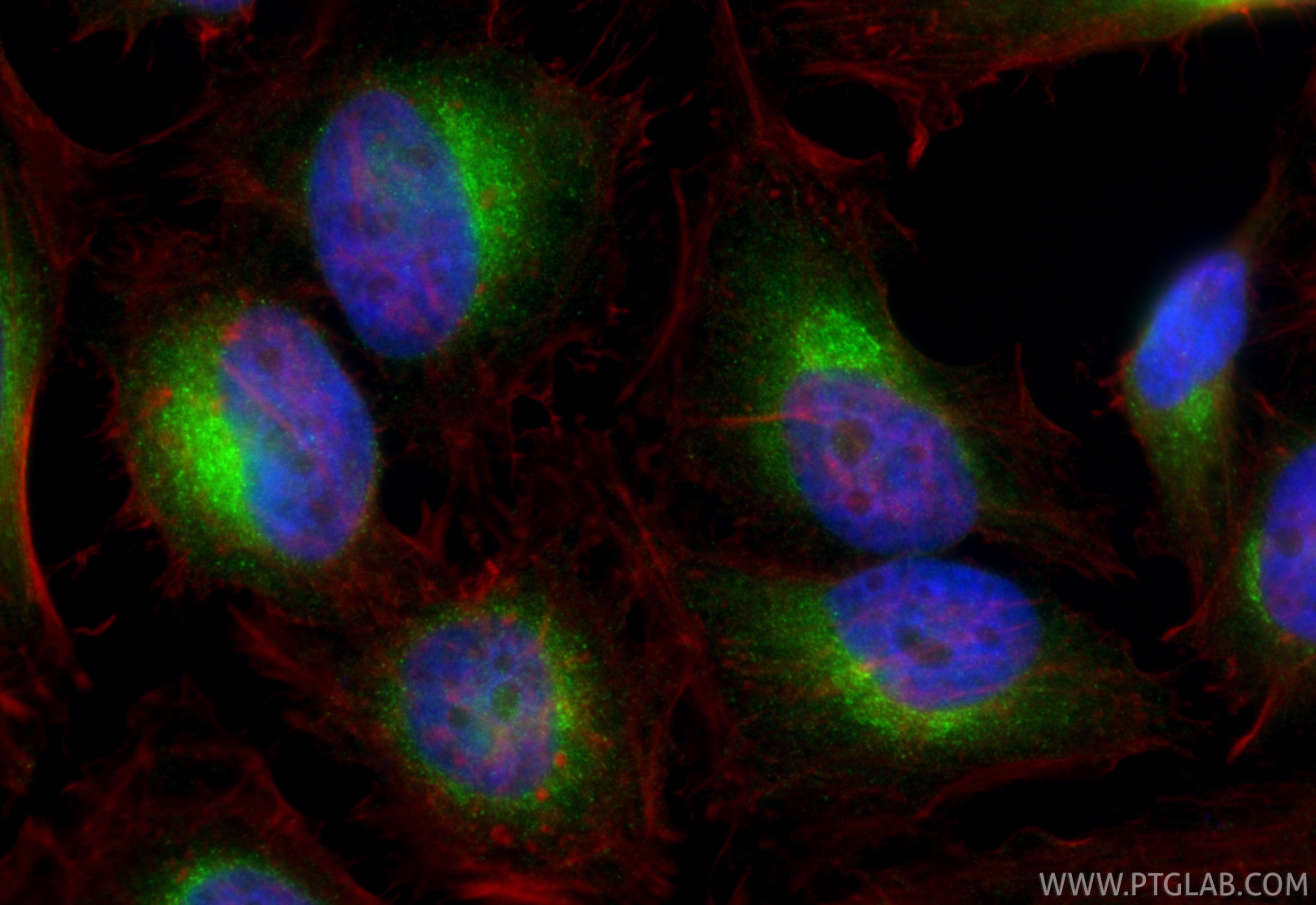 IF Staining of HeLa using 14776-1-AP Immunofluorescence (IF) / fluorescent staining of HeLa cells using SEC22B Polyclonal antibody (14776-1-AP)