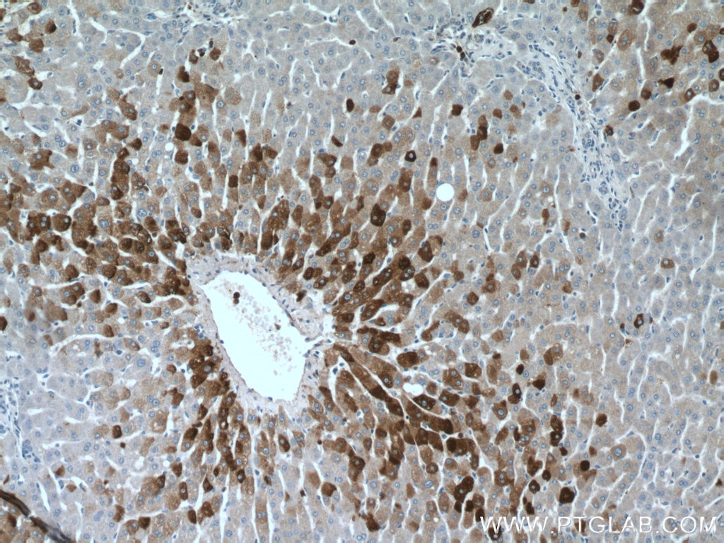 Immunohistochemistry (IHC) staining of human liver tissue using SEC22B Polyclonal antibody (14776-1-AP)
