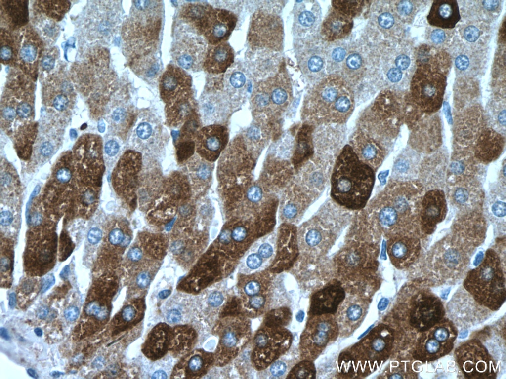 Immunohistochemistry (IHC) staining of human liver tissue using SEC22B Polyclonal antibody (14776-1-AP)