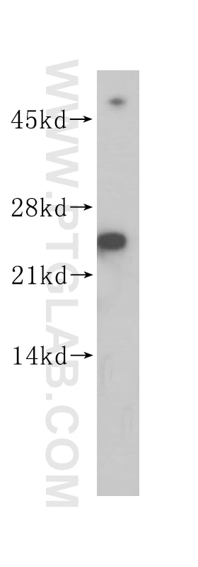 SEC22B Polyclonal antibody