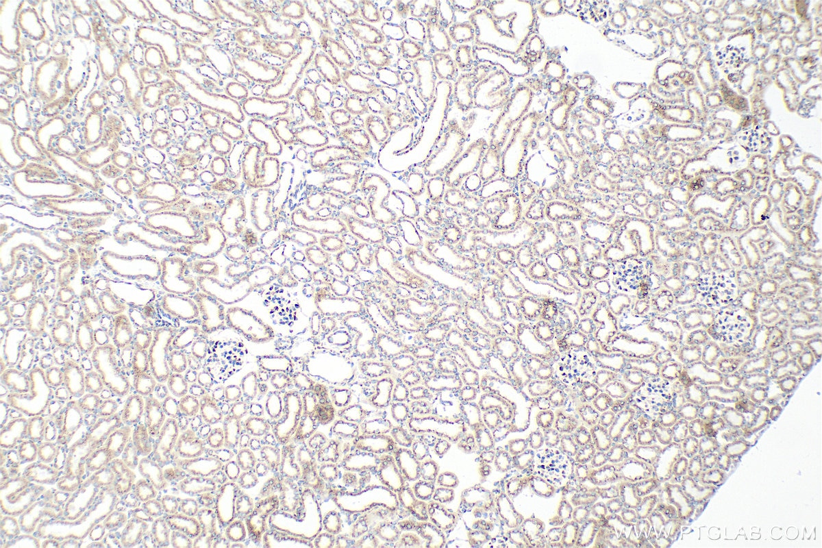 Immunohistochemical analysis of paraffin-embedded mouse kidney tissue slide using 85037-5-RR (SEC22B antibody) at dilution of 1:1000 (under 10x lens). Heat mediated antigen retrieval with Tris-EDTA buffer (pH 9.0). Immunohistochemistry (IHC) staining of mouse kidney tissue using SEC22B Recombinant monoclonal antibody (85037-5-RR)
