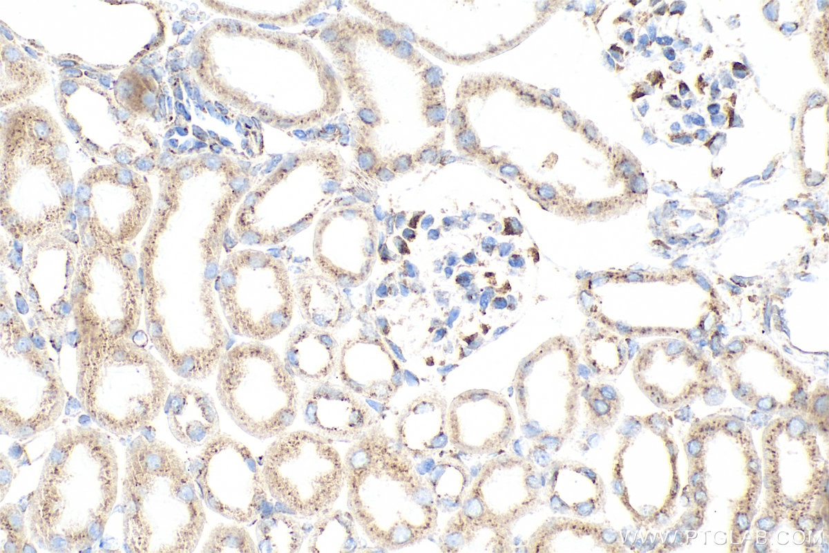 Immunohistochemical analysis of paraffin-embedded mouse kidney tissue slide using 85037-5-RR (SEC22B antibody) at dilution of 1:1000 (under 40x lens). Heat mediated antigen retrieval with Tris-EDTA buffer (pH 9.0). Immunohistochemistry (IHC) staining of mouse kidney tissue using SEC22B Recombinant monoclonal antibody (85037-5-RR)