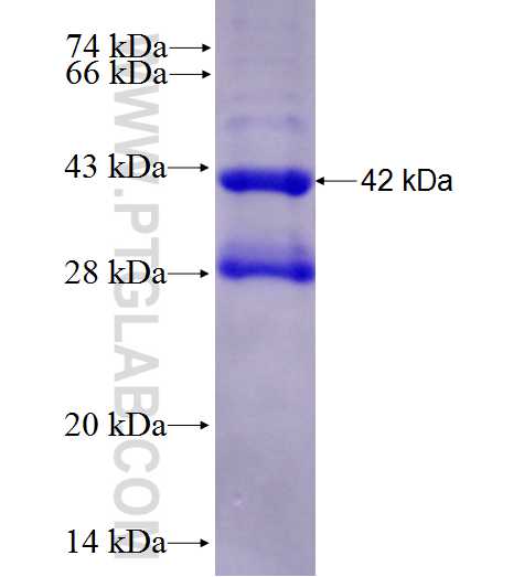 SEC22C fusion protein Ag27896 SDS-PAGE