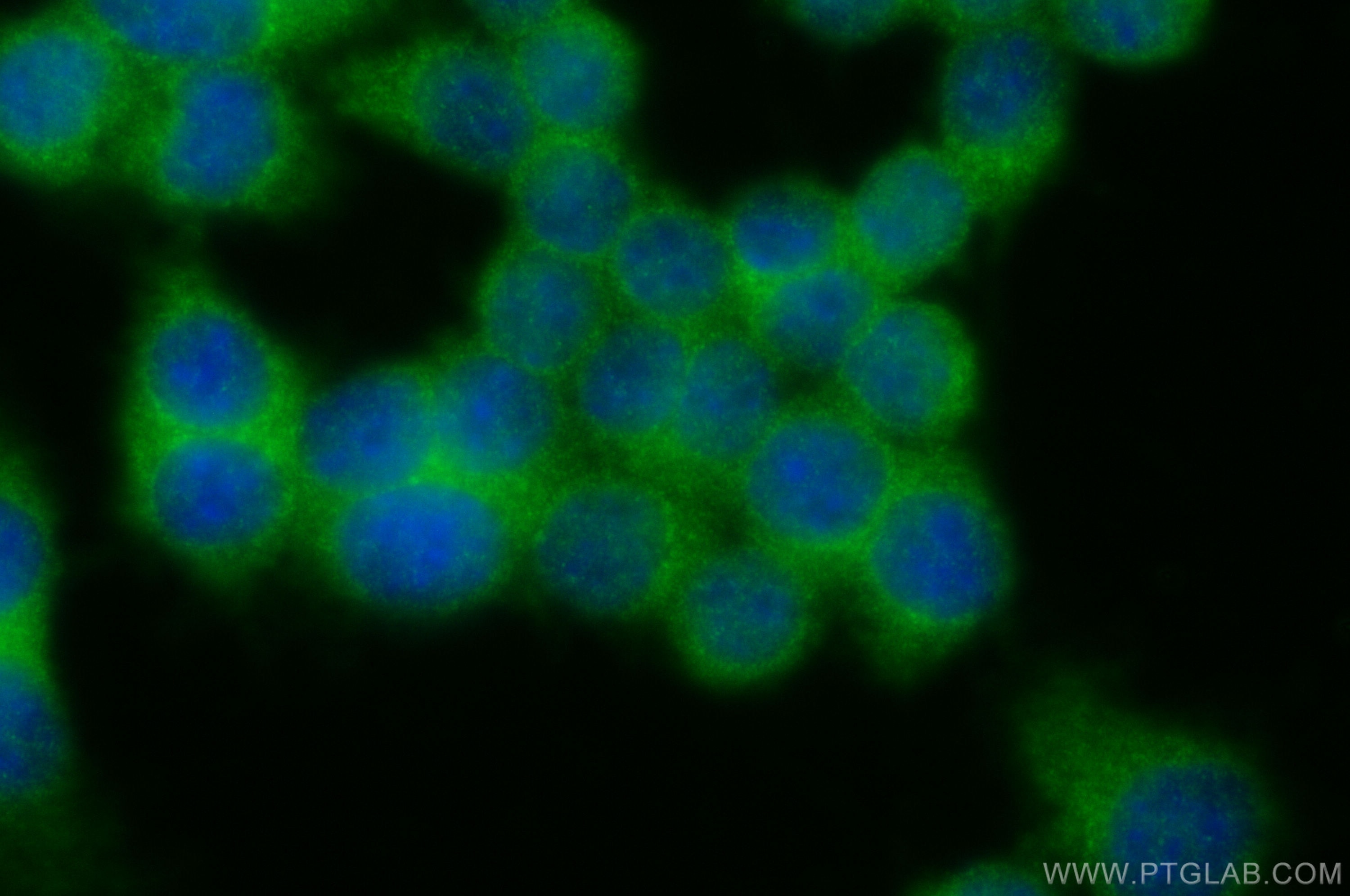 IF Staining of RAW 264.7 using 30510-1-AP