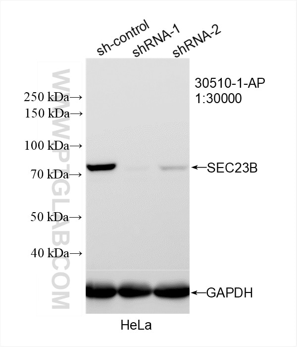 Western Blot (WB) analysis of HeLa cells using SEC23B Polyclonal antibody (30510-1-AP)
