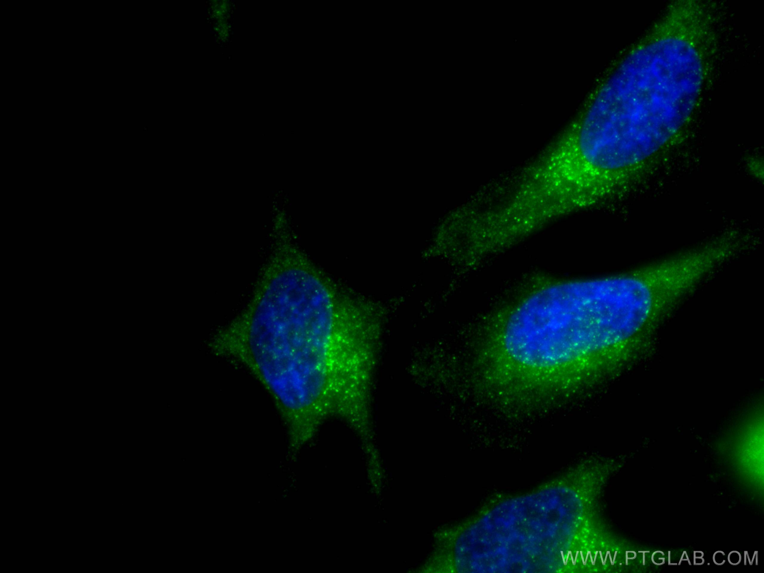 Immunofluorescence (IF) / fluorescent staining of HeLa cells using SEC23IP Polyclonal antibody (20892-1-AP)