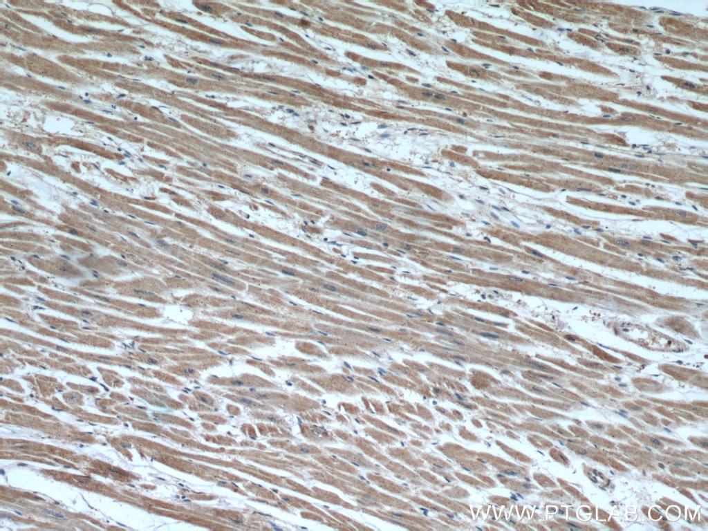 Immunohistochemistry (IHC) staining of human heart tissue using SEC23IP Polyclonal antibody (20892-1-AP)