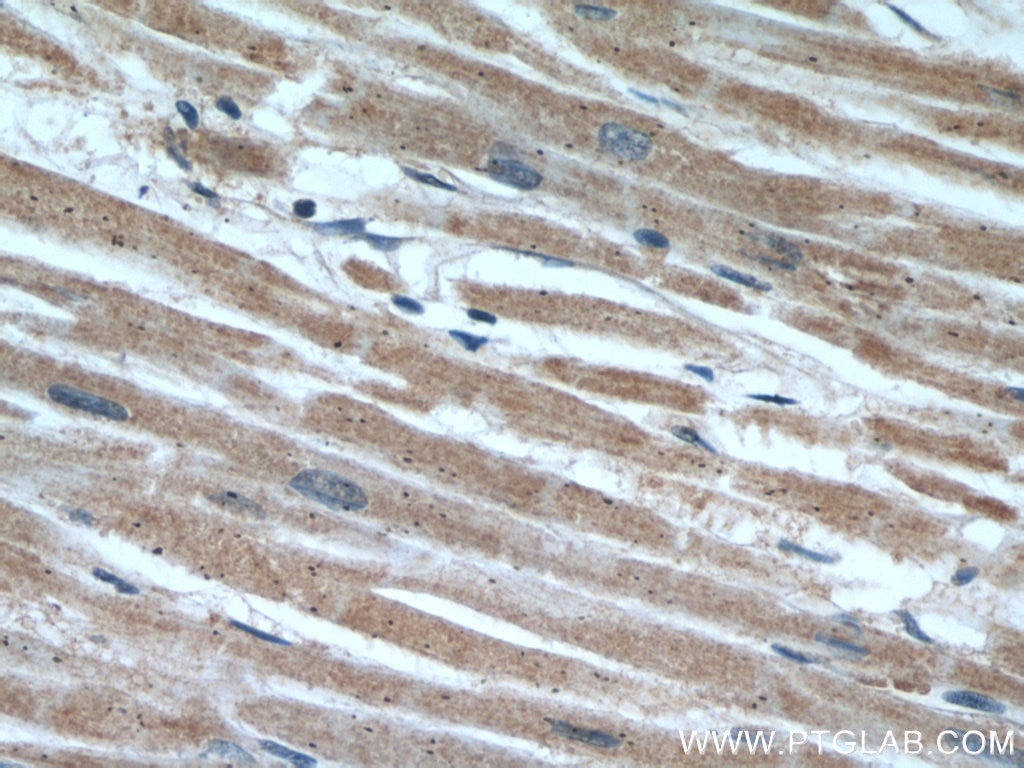 Immunohistochemistry (IHC) staining of human heart tissue using SEC23IP Polyclonal antibody (20892-1-AP)