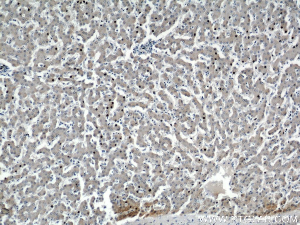 Immunohistochemistry (IHC) staining of human liver tissue using SEC23IP Polyclonal antibody (20892-1-AP)