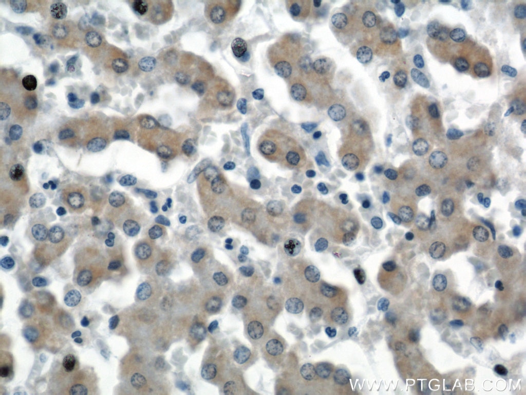 Immunohistochemistry (IHC) staining of human liver tissue using SEC23IP Polyclonal antibody (20892-1-AP)