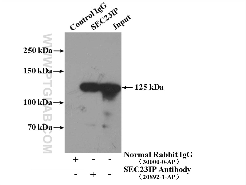 Immunoprecipitation (IP) experiment of HeLa cells using SEC23IP Polyclonal antibody (20892-1-AP)