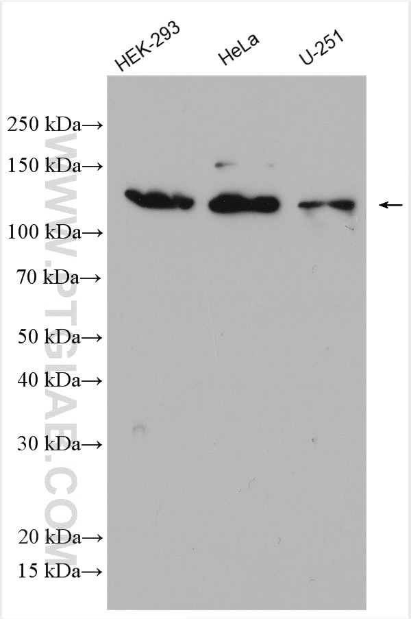 Western Blot (WB) analysis of various lysates using SEC23IP Polyclonal antibody (20892-1-AP)