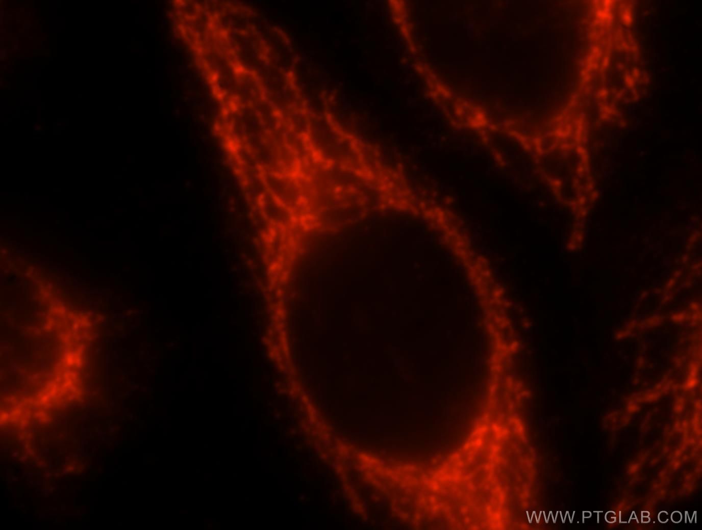 Immunofluorescence (IF) / fluorescent staining of HeLa cells using SEC24A Polyclonal antibody (15958-1-AP)