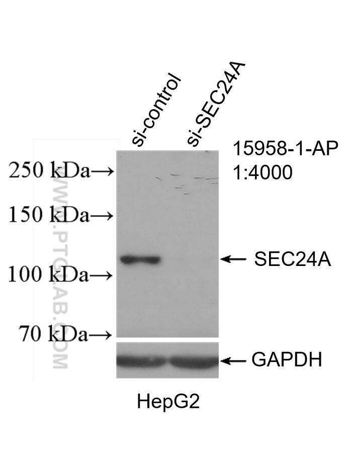 Western Blot (WB) analysis of HeLa cells using SEC24A Polyclonal antibody (15958-1-AP)