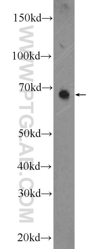 Western Blot (WB) analysis of rat thymus tissue using SEC24A Polyclonal antibody (15958-1-AP)