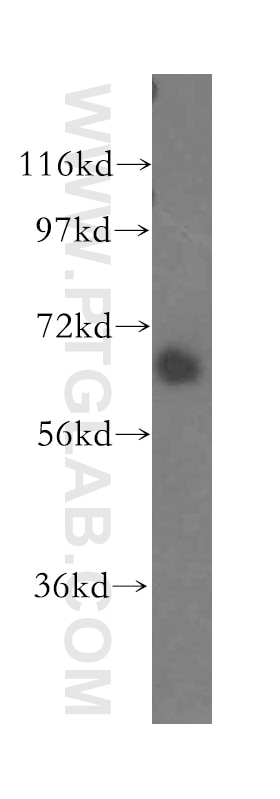 Western Blot (WB) analysis of human liver tissue using SEC24A Polyclonal antibody (15958-1-AP)