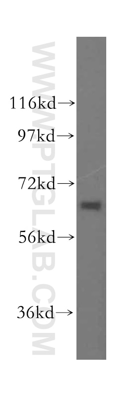 Western Blot (WB) analysis of mouse skeletal muscle tissue using SEC24A Polyclonal antibody (15958-1-AP)