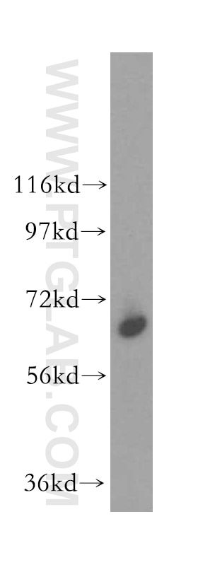 Western Blot (WB) analysis of mouse thymus tissue using SEC24A Polyclonal antibody (15958-1-AP)